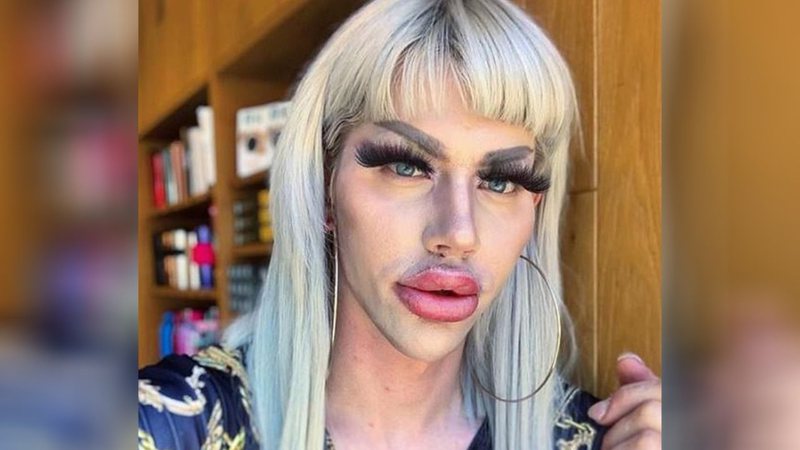 Homem que gastou R$ 110 mil para parecer Barbie diz ter dificuldade para conseguir namorada