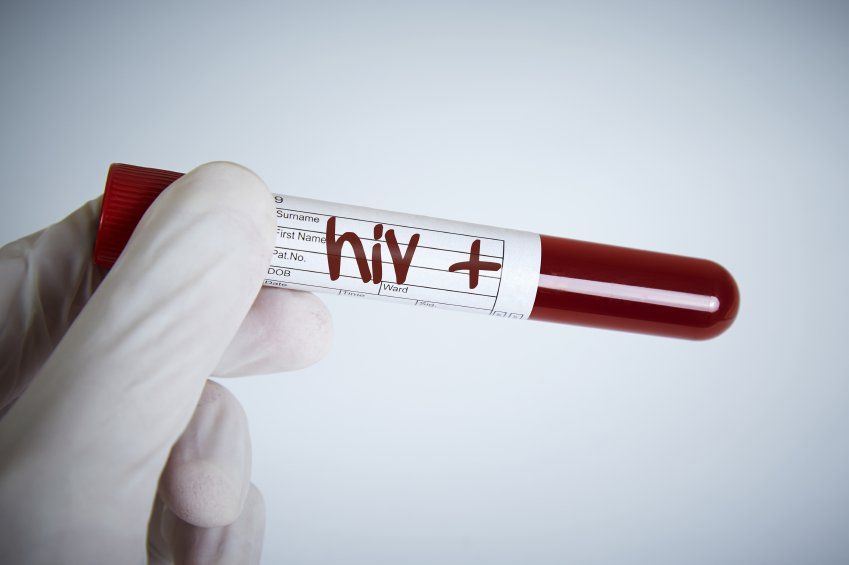 Austrália cancela vacina local após testes darem falso positivo para HIV