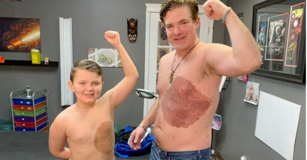 Pai tatua mancha de nascimento do filho em solidariedade a ele