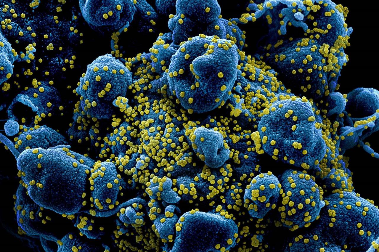 Microscópio fotografa pela 1ª vez a interação do novo coronavírus com células